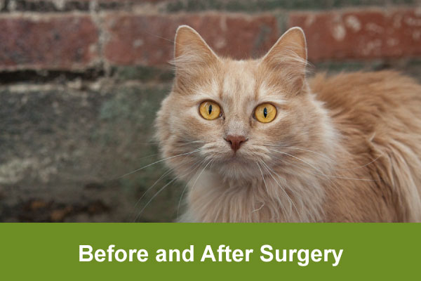 before and after surgery